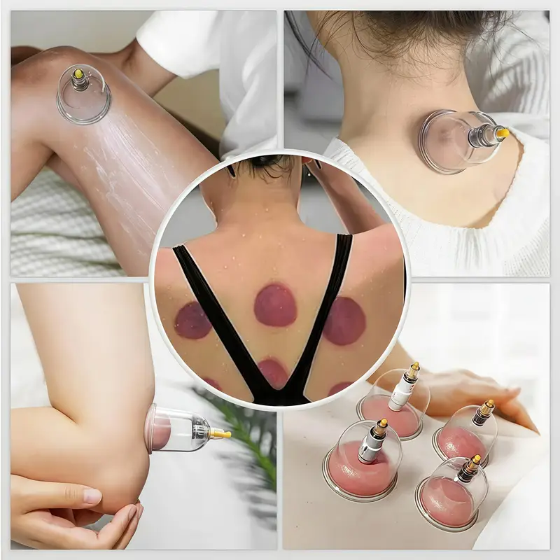 ac6f8935-d4a6-4081-b703-4566a57c76c4 1 Set Cupping Relaxation Kit with Multiple Sizes of Vacuum Cups - Image 3