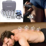 1 Set Cupping Relaxation Kit with Multiple Sizes of Vacuum Cups